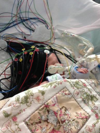 Sick ventilated infant on the neonatal intensive care unit having an optical-EEG scan