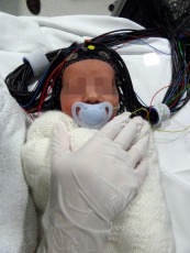 Optical-EEG cap on a healthy infant ready for scanning
