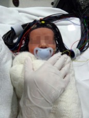Optical-EEG cap on a healthy infant ready for scanning
