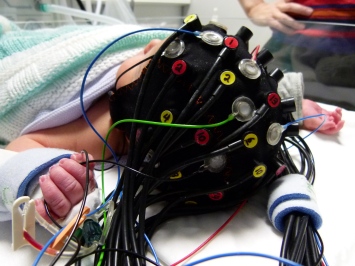 Optical-EEG cap on a healthy infant during scanning